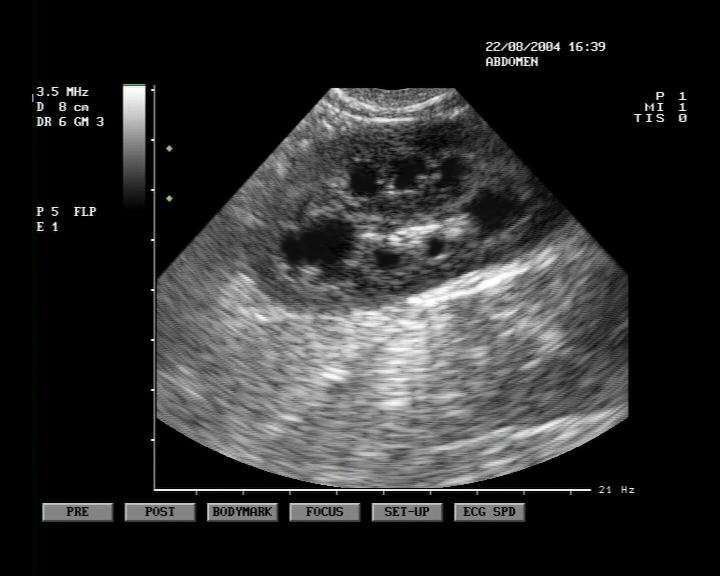 Ultrasound Image Cheshire Cat Feline Health Center