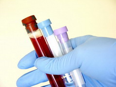 Blood Tubes, Cheshire Cat Feline Health Center Blood Tubes, Cheshire Cat Feline Health Center
