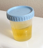 Cheshire Cat Feline Health Center urine image